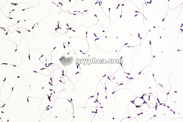 Spermatozoïdes humains x100 - gryphea.com